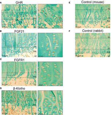 The crosstalk between FGF21 and GH leads to weakened GH receptor signaling and IGF1 expression and is associated with growth failure in very preterm infants